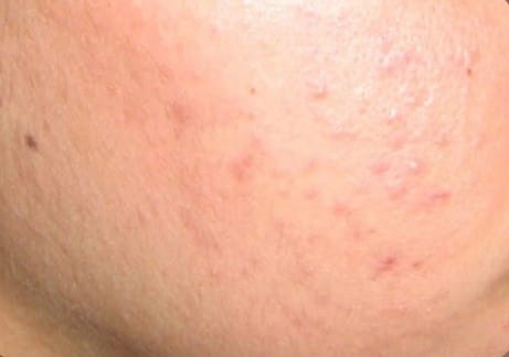 Picture1